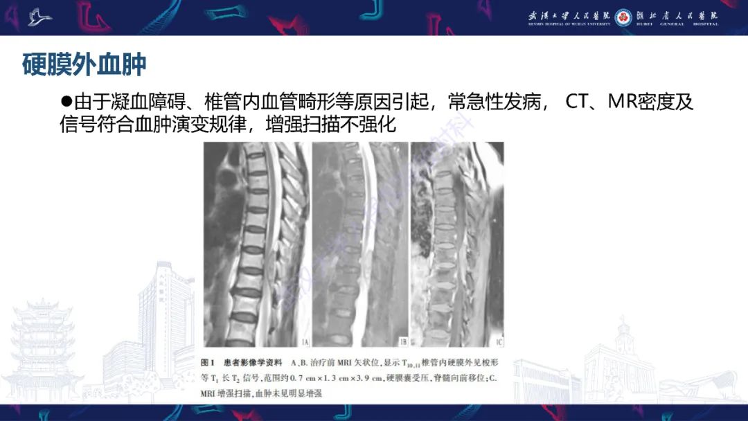 【PPT】原发性椎管内淋巴瘤影像诊断