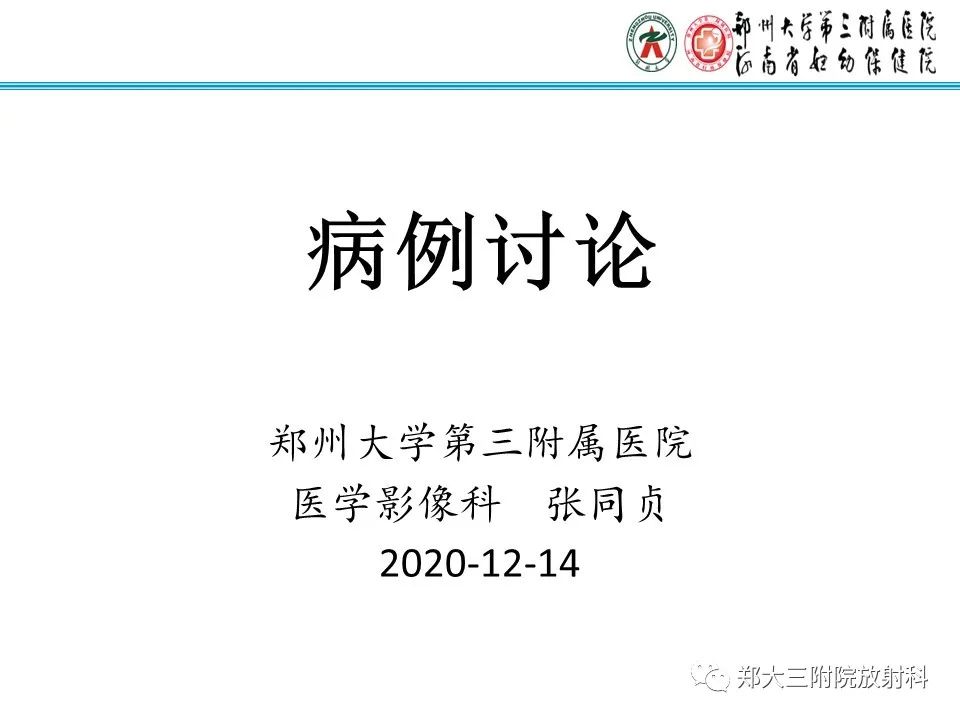 【病例】卵巢子宫内膜样癌1例MR影像诊断