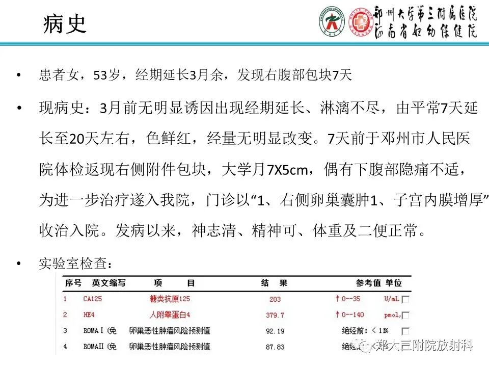 【病例】卵巢子宫内膜样癌1例MR影像诊断