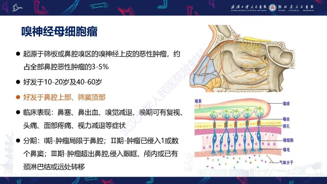影像PPT - 【PPT】鼻腔鼻窦神经内分泌癌影像诊断及鉴别诊断-24
