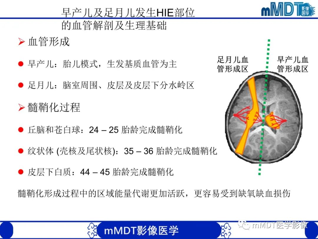 影像PPT - 【PPT】新生儿HIE影像学表现-4 影像PPT - 【PPT】新生儿HIE影像学表现-4