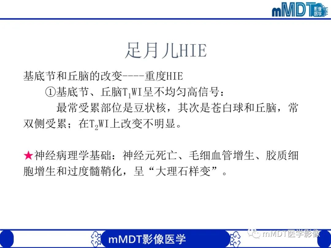 影像PPT - 【PPT】新生儿HIE影像学表现-28 影像PPT - 【PPT】新生儿HIE影像学表现-28