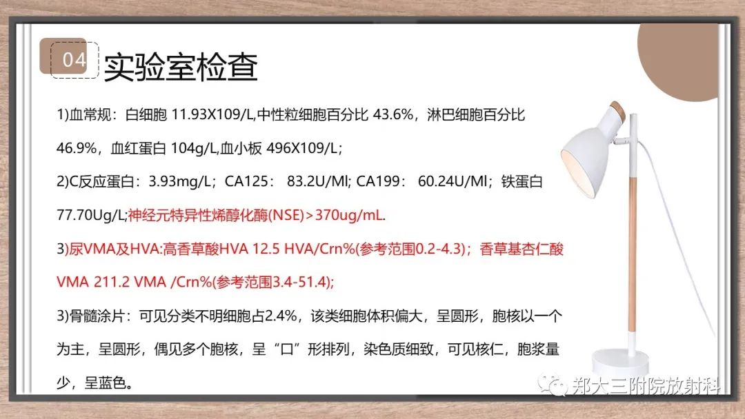 影像PPT - 【病例】神经母细胞瘤1例CT影像鉴别诊断-7