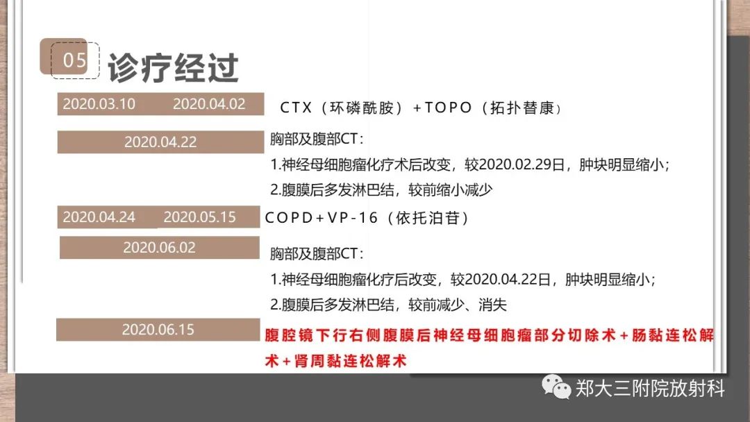 影像PPT - 【病例】神经母细胞瘤1例CT影像鉴别诊断-8