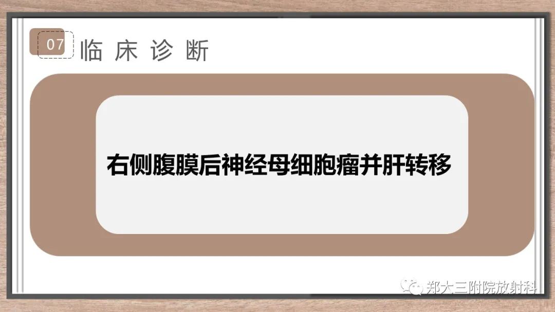 影像PPT - 【病例】神经母细胞瘤1例CT影像鉴别诊断-9