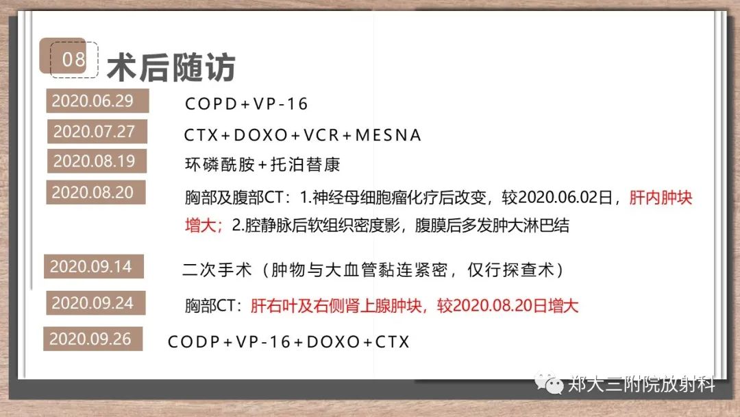 影像PPT - 【病例】神经母细胞瘤1例CT影像鉴别诊断-10