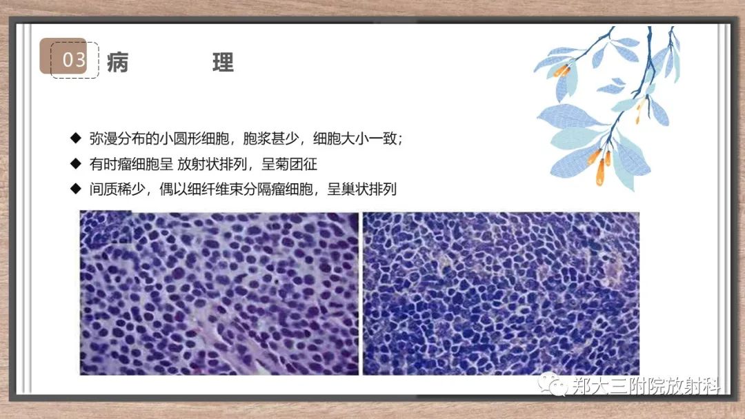 影像PPT - 【病例】神经母细胞瘤1例CT影像鉴别诊断-15