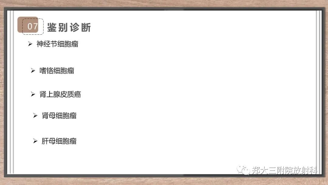 影像PPT - 【病例】神经母细胞瘤1例CT影像鉴别诊断-21