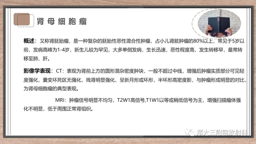 影像PPT - 【病例】神经母细胞瘤1例CT影像鉴别诊断-28