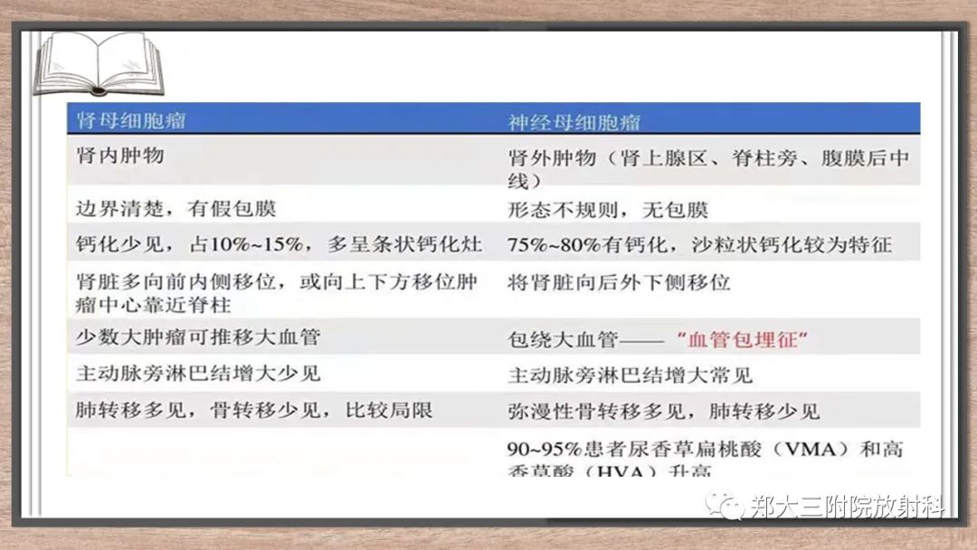 影像PPT - 【病例】神经母细胞瘤1例CT影像鉴别诊断-29