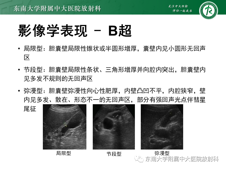 影像PPT - 【病例】胆囊腺肌症1例CT影像诊断-9