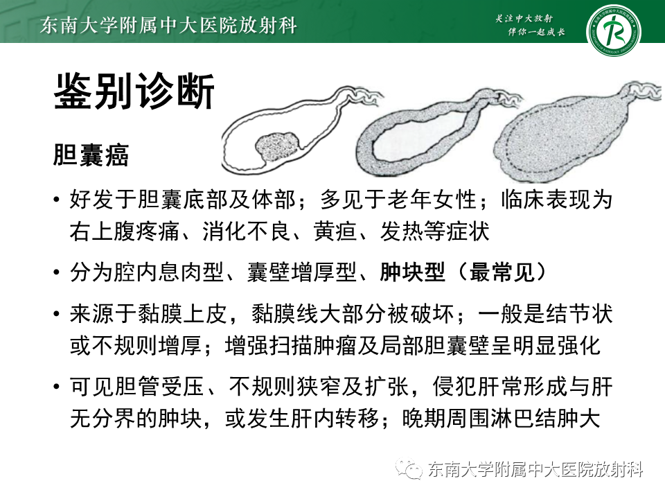 影像PPT - 【病例】胆囊腺肌症1例CT影像诊断-10