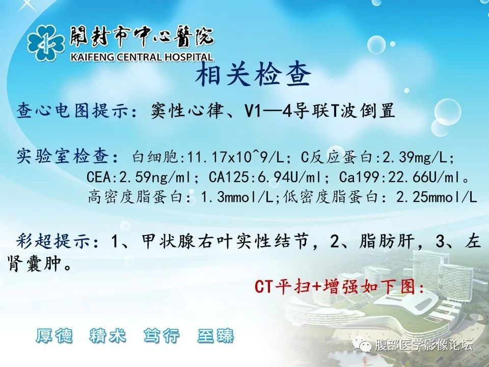 影像PPT - 【病例】肠系膜淋巴管(脂肪)瘤1例CT影像-3