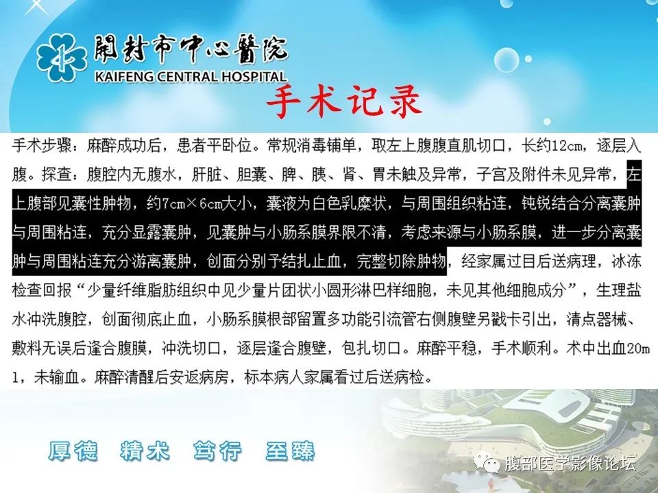 影像PPT - 【病例】肠系膜淋巴管(脂肪)瘤1例CT影像-18