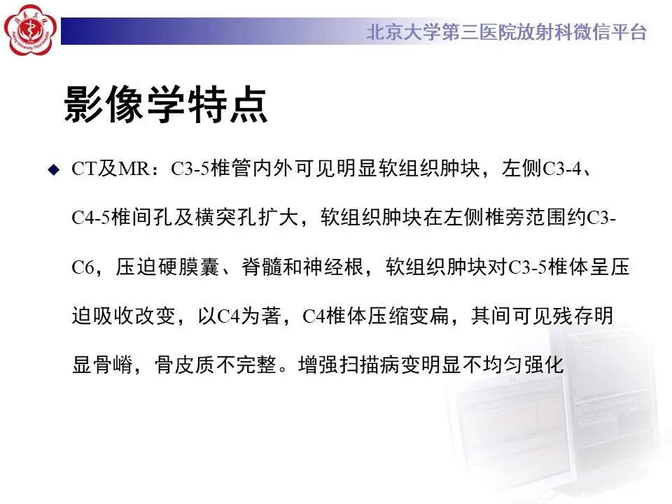 影像PPT - 【PPT】脊柱骨内神经鞘瘤的影像-5