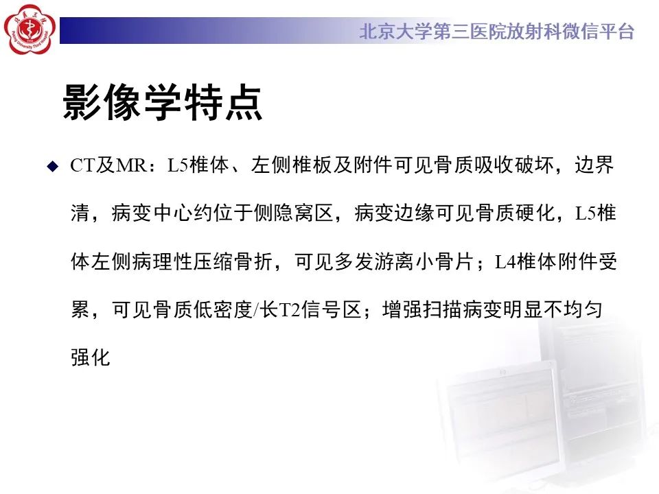 影像PPT - 【PPT】脊柱骨内神经鞘瘤的影像-9