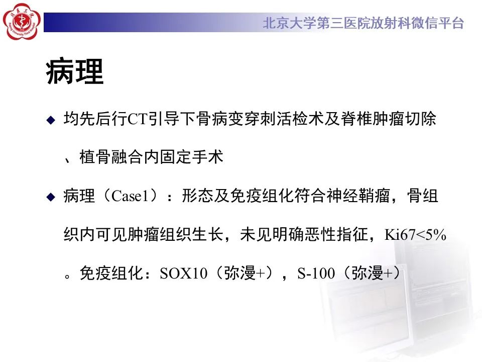 影像PPT - 【PPT】脊柱骨内神经鞘瘤的影像-11