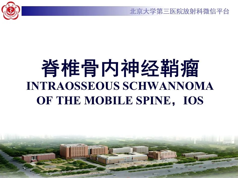 影像PPT - 【PPT】脊柱骨内神经鞘瘤的影像-12