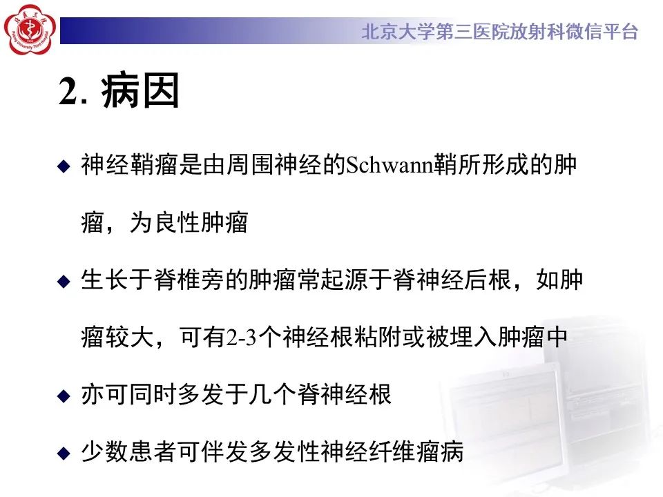 影像PPT - 【PPT】脊柱骨内神经鞘瘤的影像-15