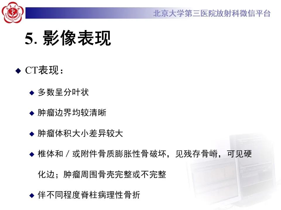 影像PPT - 【PPT】脊柱骨内神经鞘瘤的影像-20