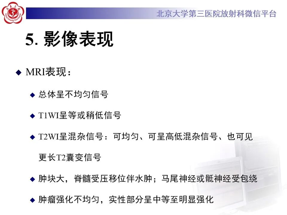 影像PPT - 【PPT】脊柱骨内神经鞘瘤的影像-21