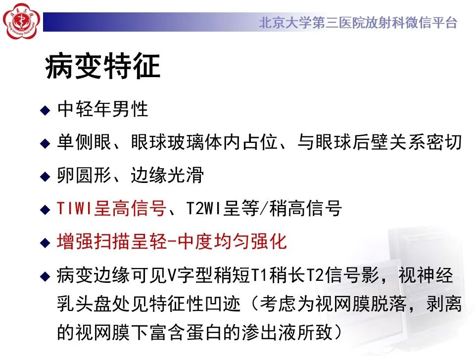 影像PPT - 【PPT】脉络膜黑色素瘤的影像-6