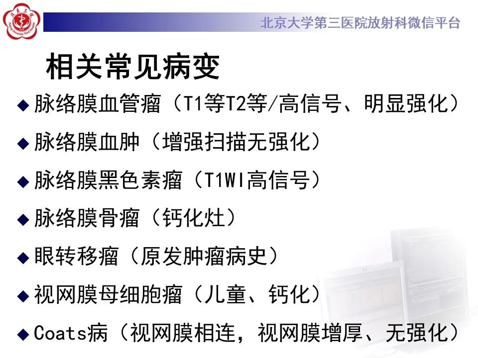 影像PPT - 【PPT】脉络膜黑色素瘤的影像-7