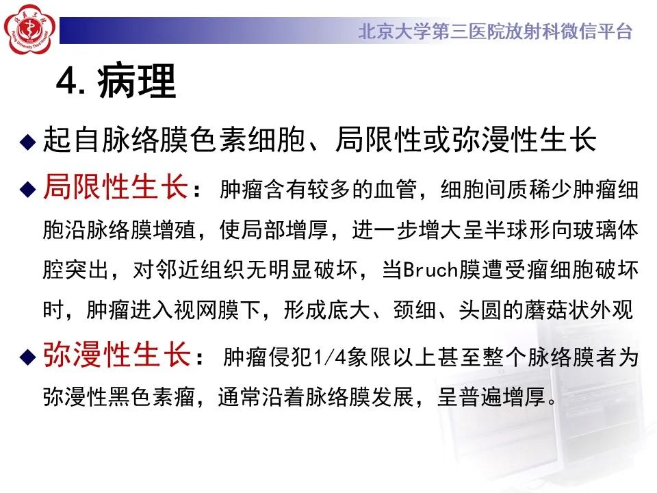 影像PPT - 【PPT】脉络膜黑色素瘤的影像-14