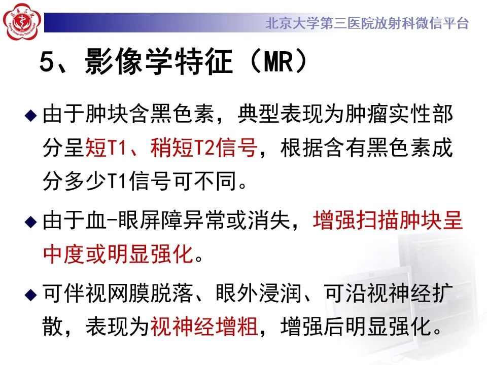 影像PPT - 【PPT】脉络膜黑色素瘤的影像-18