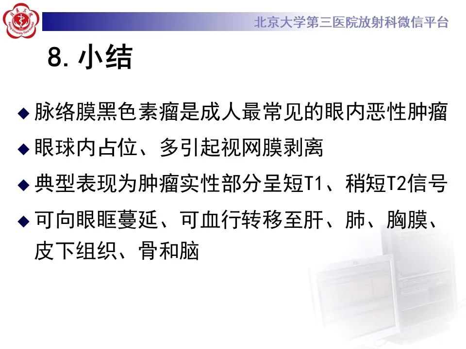 影像PPT - 【PPT】脉络膜黑色素瘤的影像-39