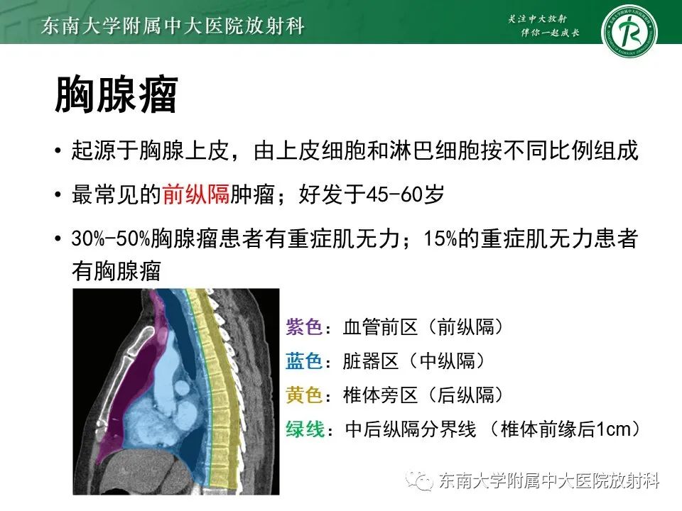 影像PPT - 【病例】胸腺瘤1例CT影像诊断-4