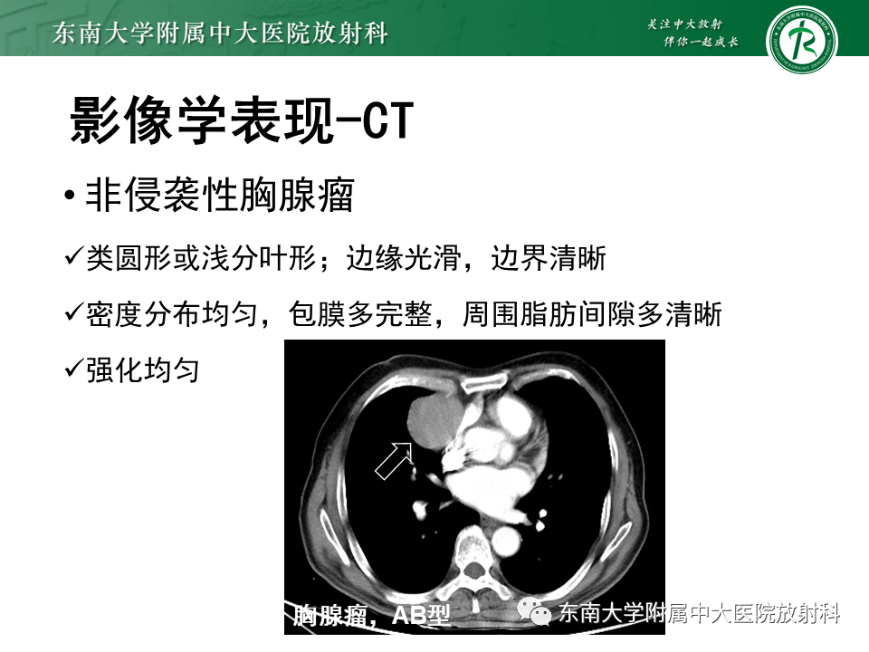 影像PPT - 【病例】胸腺瘤1例CT影像诊断-8