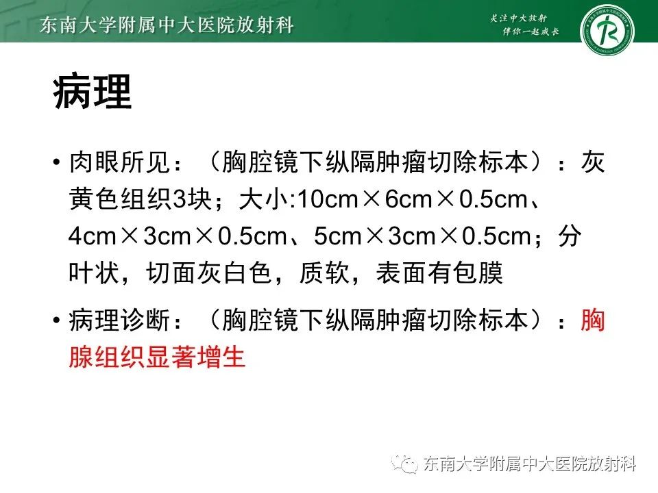 影像PPT - 【病例】胸腺瘤1例CT影像诊断-13