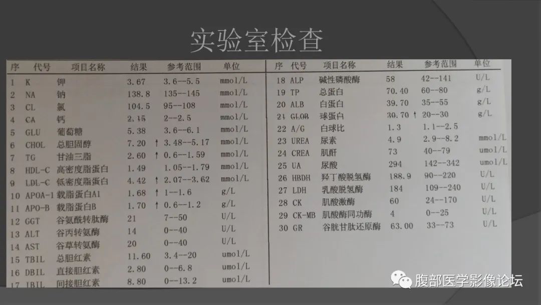 影像PPT - 【病例】子宫内膜癌肉瘤1例MR影像-3