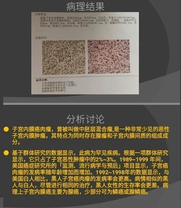 影像PPT - 【病例】子宫内膜癌肉瘤1例MR影像-15