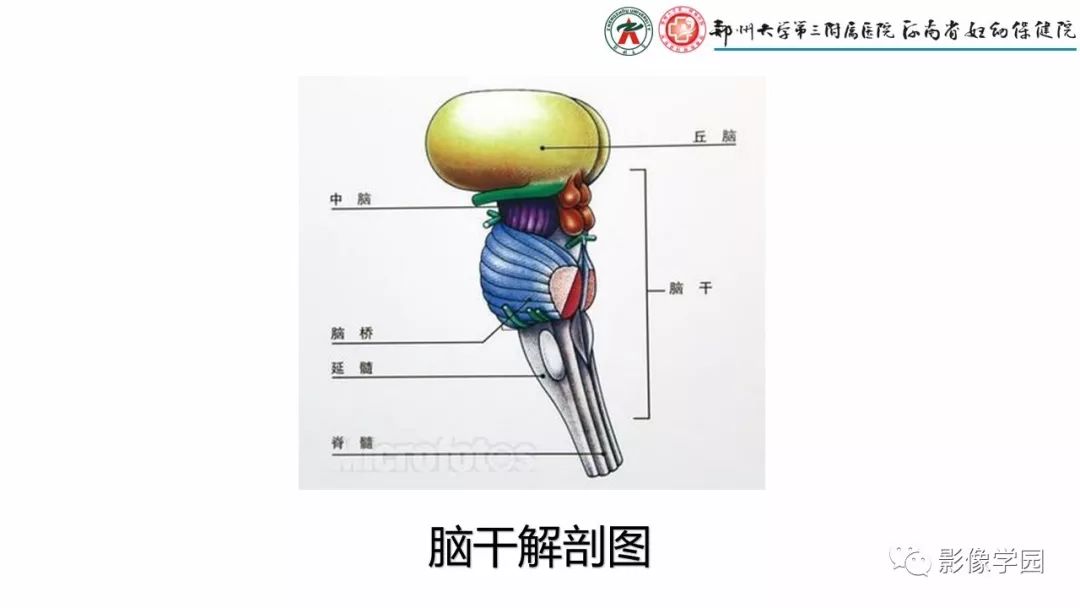 影像PPT - 【PPT】脑干病变的影像学表现-3