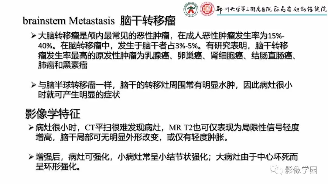影像PPT - 【PPT】脑干病变的影像学表现-11