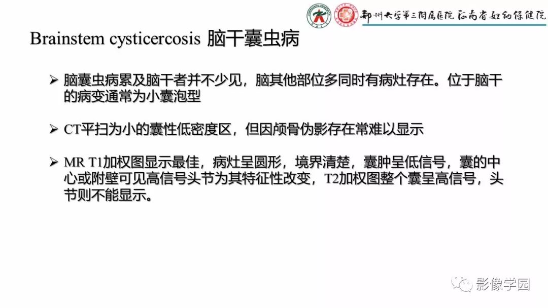 影像PPT - 【PPT】脑干病变的影像学表现-21