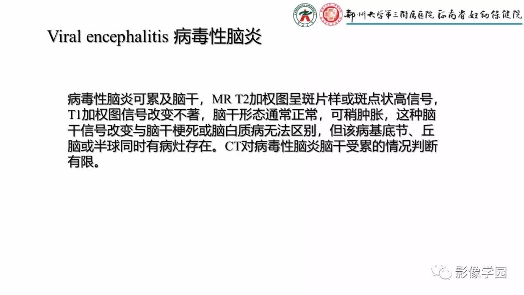 影像PPT - 【PPT】脑干病变的影像学表现-23