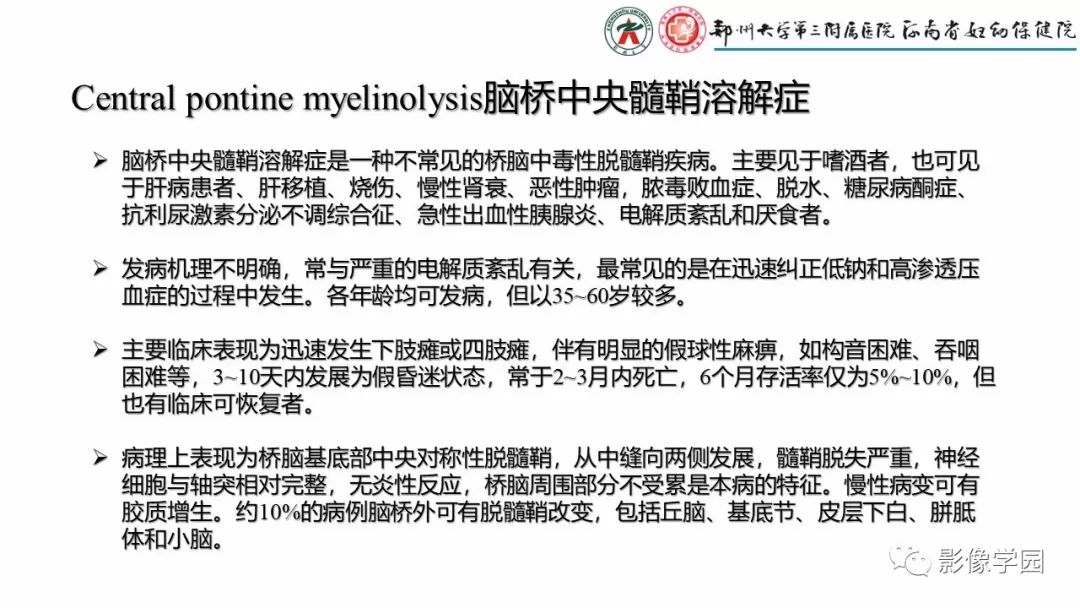 影像PPT - 【PPT】脑干病变的影像学表现-25