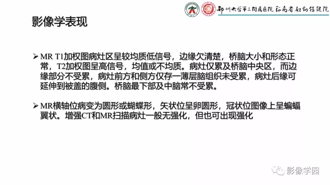 影像PPT - 【PPT】脑干病变的影像学表现-26