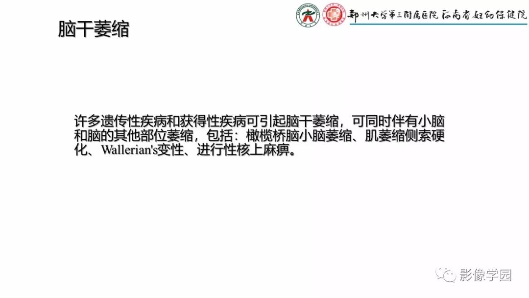 影像PPT - 【PPT】脑干病变的影像学表现-29