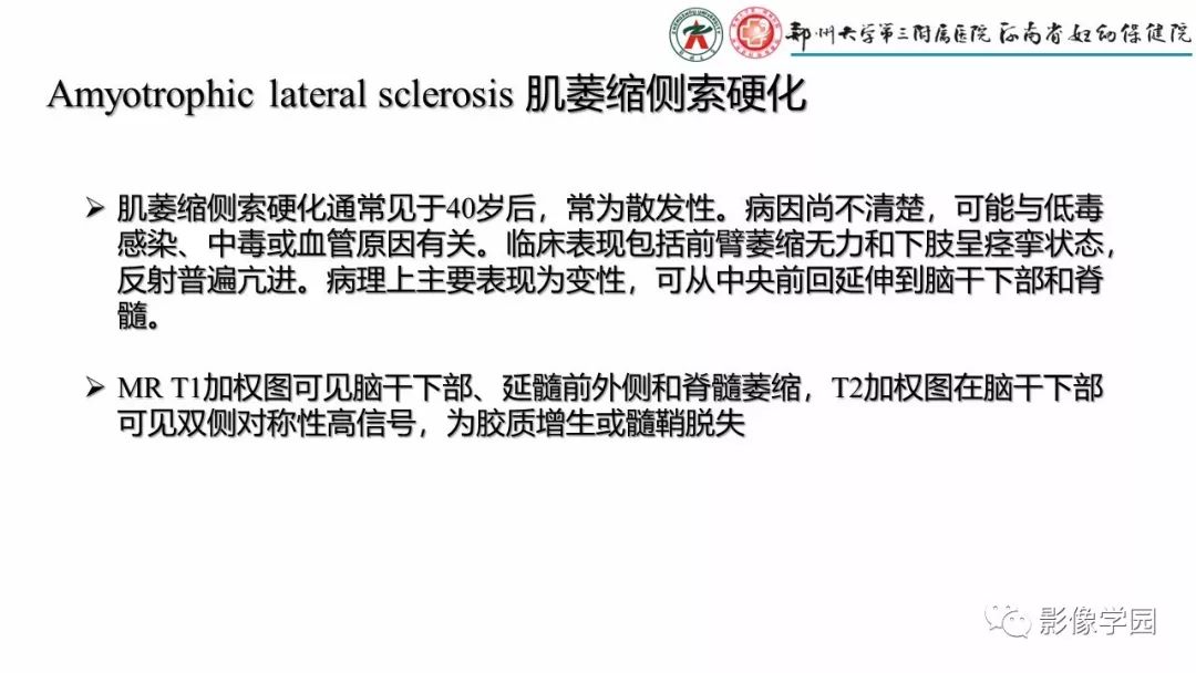 影像PPT - 【PPT】脑干病变的影像学表现-32