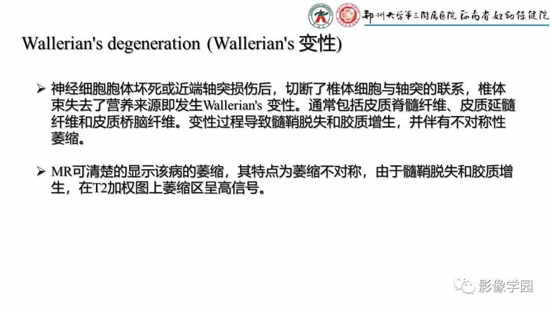 影像PPT - 【PPT】脑干病变的影像学表现-33