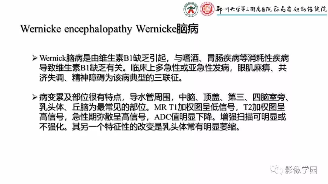 影像PPT - 【PPT】脑干病变的影像学表现-37