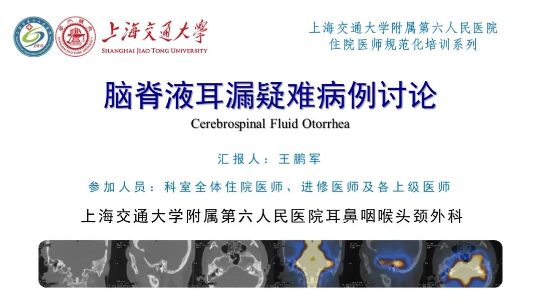 影像PPT - 【病例】脑脊液耳漏1例CT及MR病例讨论-1