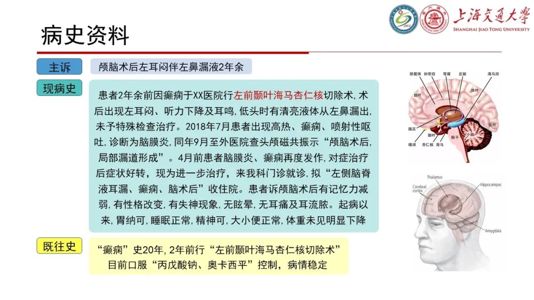 影像PPT - 【病例】脑脊液耳漏1例CT及MR病例讨论-2