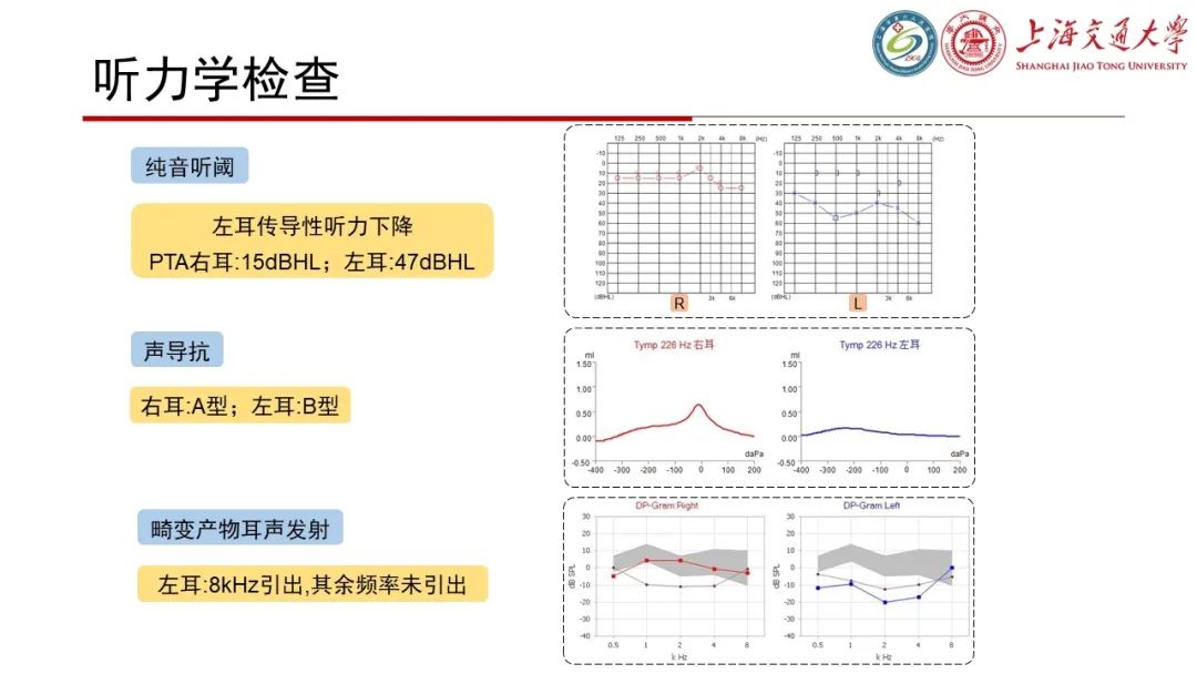 影像PPT - 【病例】脑脊液耳漏1例CT及MR病例讨论-4