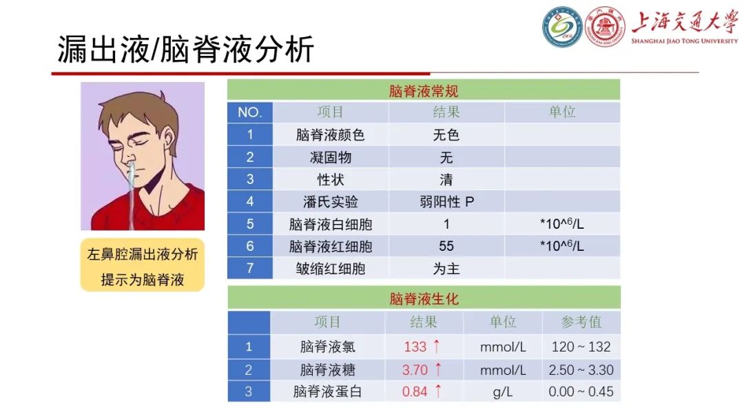 影像PPT - 【病例】脑脊液耳漏1例CT及MR病例讨论-5
