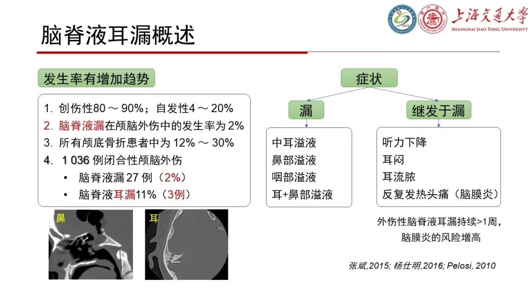 影像PPT - 【病例】脑脊液耳漏1例CT及MR病例讨论-14